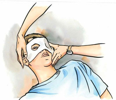 Eye-Injury